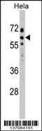 Suppressor Of Cytokine Signaling 7 antibody, 58-953, ProSci, Western Blot image 