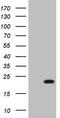 High Mobility Group Box 4 antibody, M14163, Boster Biological Technology, Western Blot image 