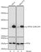 Ribosomal Protein S6 antibody, GTX66604, GeneTex, Western Blot image 