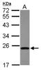 Cyclin D3 antibody, NBP1-31806, Novus Biologicals, Western Blot image 