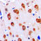 Activin A Receptor Like Type 1 antibody, LS-C351792, Lifespan Biosciences, Immunohistochemistry paraffin image 