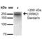 Leucine Rich Repeat Kinase 2 antibody, 56582, QED Bioscience, Western Blot image 