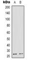 Transmembrane BAX Inhibitor Motif Containing 4 antibody, abx133535, Abbexa, Western Blot image 