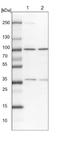 Transducin Beta Like 3 antibody, NBP1-92481, Novus Biologicals, Western Blot image 