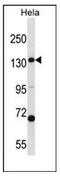 Carbamoyl-Phosphate Synthase 1 antibody, AP51056PU-N, Origene, Western Blot image 