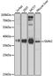 Survival Of Motor Neuron 2, Centromeric antibody, A12519, ABclonal Technology, Western Blot image 