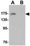 SH3 And Multiple Ankyrin Repeat Domains 3 antibody, GTX31480, GeneTex, Western Blot image 