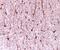 Ciliary Neurotrophic Factor antibody, AB-557-NA, R&D Systems, Immunohistochemistry paraffin image 