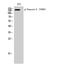 Tensin 2 antibody, STJ90428, St John