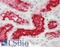 Angiotensin I Converting Enzyme 2 antibody, LS-C790163, Lifespan Biosciences, Immunohistochemistry paraffin image 