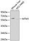 Myotubularin 1 antibody, GTX32731, GeneTex, Western Blot image 