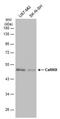 Calcium/Calmodulin Dependent Protein Kinase II Delta antibody, MA5-27735, Invitrogen Antibodies, Western Blot image 