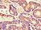 Cyclin Dependent Kinase 2 antibody, A62242-100, Epigentek, Immunohistochemistry paraffin image 