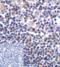 CD276 Molecule antibody, RF16092, ProSci Inc, Immunohistochemistry frozen image 