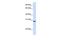 Troponin T, fast skeletal muscle antibody, GTX45865, GeneTex, Western Blot image 