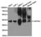 CAPZA2 antibody, TA327244, Origene, Western Blot image 