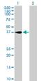 Ring Finger Protein 41 antibody, H00010193-B01P, Novus Biologicals, Western Blot image 