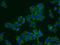 Transgelin 2 antibody, 10234-2-AP, Proteintech Group, Immunofluorescence image 