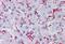 Paxillin antibody, MBS244188, MyBioSource, Immunohistochemistry paraffin image 
