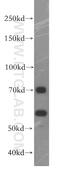 Fem-1 Homolog B antibody, 19544-1-AP, Proteintech Group, Western Blot image 