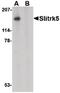 SLIT and NTRK-like protein 5 antibody, PA5-20477, Invitrogen Antibodies, Western Blot image 