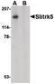 SLIT And NTRK Like Family Member 5 antibody, PA5-20477, Invitrogen Antibodies, Western Blot image 