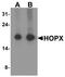 HOP Homeobox antibody, PA5-72855, Invitrogen Antibodies, Western Blot image 