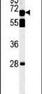 TBK1 Binding Protein 1 antibody, PA5-25240, Invitrogen Antibodies, Western Blot image 