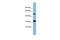 Ly1 Antibody Reactive antibody, PA5-44683, Invitrogen Antibodies, Western Blot image 