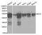 Keratin 8 antibody, A1024, ABclonal Technology, Western Blot image 