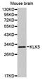 Kallikrein Related Peptidase 5 antibody, PA5-76686, Invitrogen Antibodies, Western Blot image 