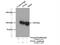 Glycogen phosphorylase, liver form antibody, 55429-1-AP, Proteintech Group, Immunoprecipitation image 