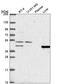 Phosphorylase Kinase Catalytic Subunit Gamma 2 antibody, HPA065618, Atlas Antibodies, Western Blot image 