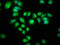 Aralkylamine N-Acetyltransferase antibody, LS-C671118, Lifespan Biosciences, Immunofluorescence image 