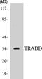 TNFRSF1A Associated Via Death Domain antibody, EKC1574, Boster Biological Technology, Western Blot image 