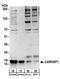 Calcium-regulated heat stable protein 1 antibody, A303-908A, Bethyl Labs, Western Blot image 