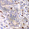 S100 Calcium Binding Protein A12 antibody, A5328, ABclonal Technology, Immunohistochemistry paraffin image 
