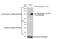 LYN Proto-Oncogene, Src Family Tyrosine Kinase antibody, GTX101222, GeneTex, Western Blot image 