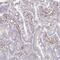 SSH-2L antibody, NBP2-49245, Novus Biologicals, Immunohistochemistry frozen image 