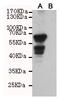 PX Domain Containing Serine/Threonine Kinase Like antibody, STJ99156, St John