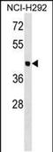 Otolin 1 antibody, PA5-48732, Invitrogen Antibodies, Western Blot image 