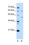 Replication Factor C Subunit 5 antibody, NBP1-58108, Novus Biologicals, Western Blot image 