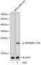 Eukaryotic Translation Initiation Factor 4E Binding Protein 1 antibody, GTX53981, GeneTex, Western Blot image 