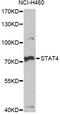 Signal Transducer And Activator Of Transcription 4 antibody, STJ29071, St John