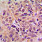 DEAD-Box Helicase 3 X-Linked antibody, LS-C358966, Lifespan Biosciences, Immunohistochemistry paraffin image 