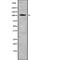 BTB Domain And CNC Homolog 1 antibody, abx148523, Abbexa, Western Blot image 