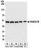 Rab Geranylgeranyltransferase Subunit Beta antibody, NBP2-32214, Novus Biologicals, Western Blot image 