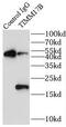Mitochondrial import inner membrane translocase subunit Tim17-B antibody, FNab08698, FineTest, Immunoprecipitation image 