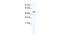 Gamma-Aminobutyric Acid Type A Receptor Epsilon Subunit antibody, ARP35342_P050, Aviva Systems Biology, Western Blot image 