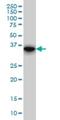 Four And A Half LIM Domains 1 antibody, H00002273-M01, Novus Biologicals, Western Blot image 